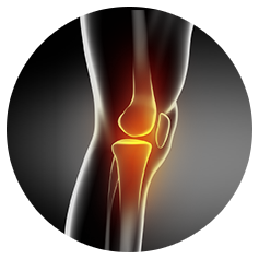orthopedics in melbourne Melbourne Hip and Knee
